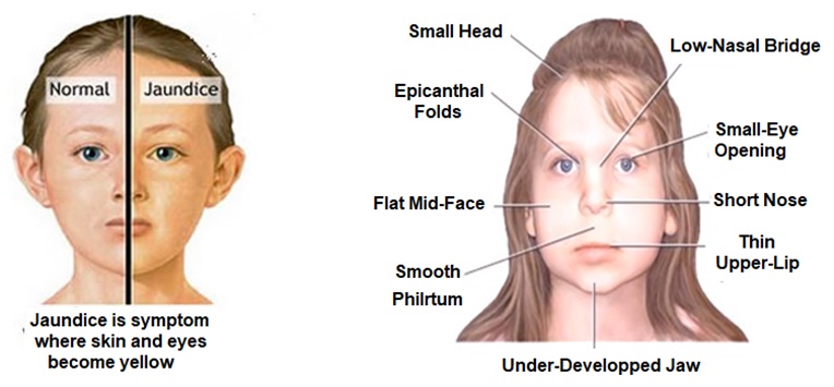 Illustrates some kinds of face disease