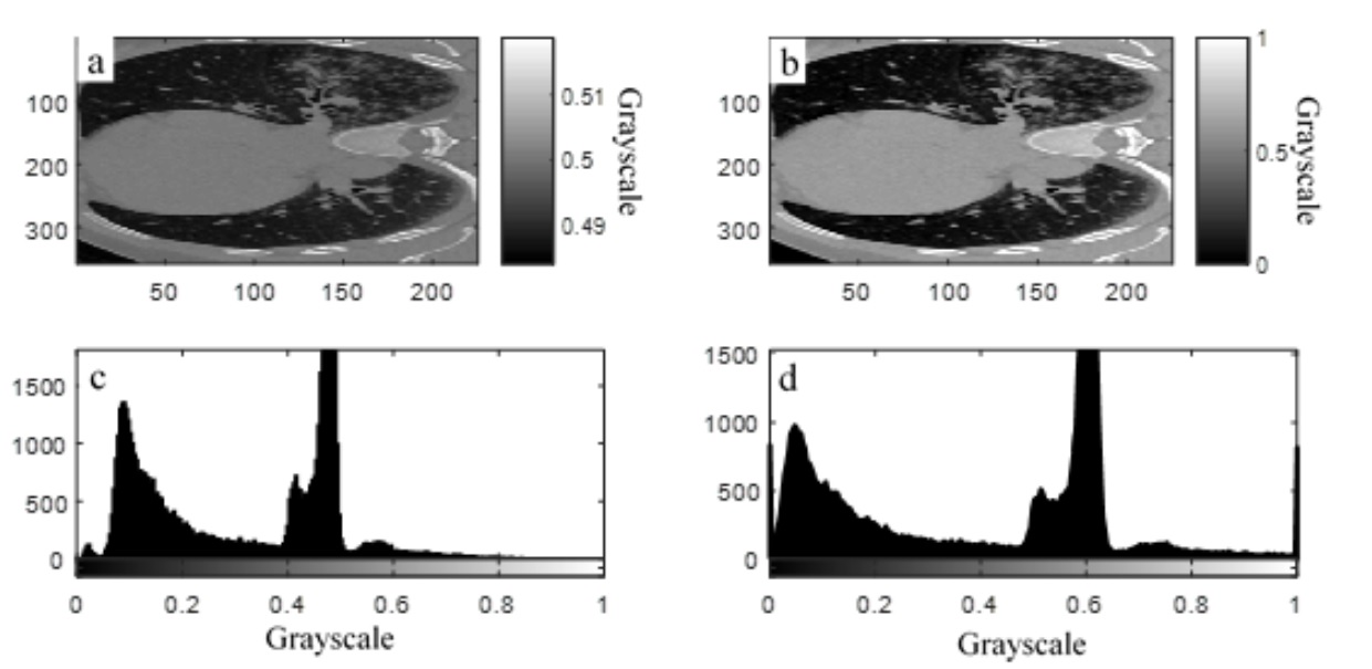 Grayscale CT, (a) acquired image, (b) intensity adjusted image, (c) histogram of acquired image, (d) histogram of intensity adjusted image