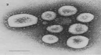 SARS-CoV-19 image from an electron microscope