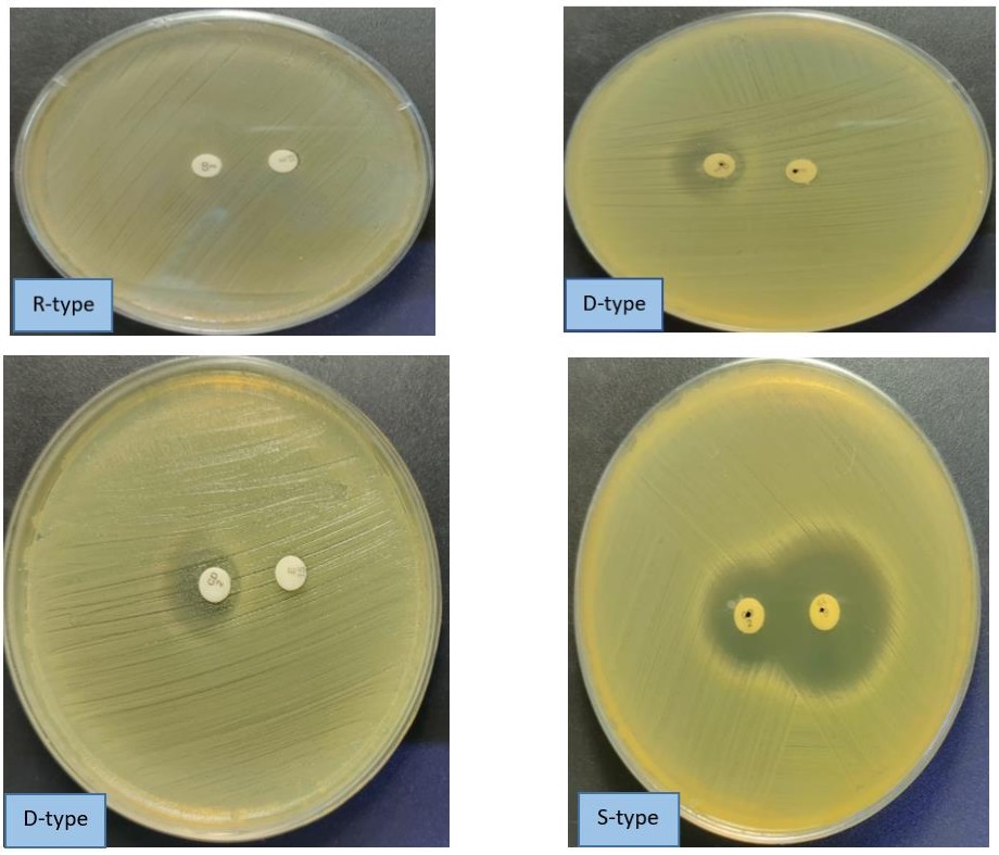 Phenotypic representation of clindamycin resistance showing MRSA in M.H.A. media